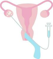 opu eicel plukken omhoog vector illustratie. perfect voor presenteren iets over reproductie, inseminatie of ivf.