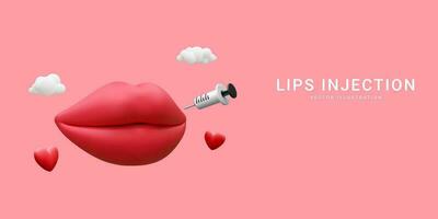 3d realistisch banier voor lip injectie. concept van dermatologie en schoonheidsspecialiste behandeling. rood esthetisch mooi lippen met medisch plastic injectiespuit met kunstmatig injectie in tekenfilm stijl vector