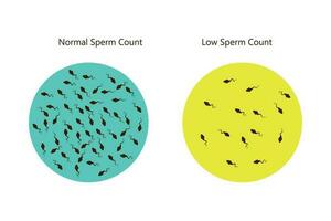 normaal en laag sperma tellen illustratie. mannetje onvruchtbaarheid oligospermie. structuur van de sperma. vector. eps 10 vector