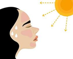 een vrouw gezicht met zonnesteek, hebben zonnesteek in zomer heet het weer. vlak vector illustratie.