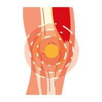 artritis pijn in de benen vector