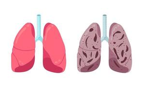 gezonde en ongezonde longen vergelijken concept. menselijk ademhalingssysteem inwendig orgaan sterk en longontsteking ontsteking. gezondheidszorg ademhaling medische aandoening anatomie vectorillustratie vector