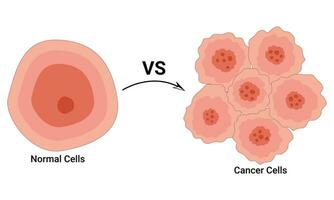 normaal cel en kanker cel ontwerp vector illustratie