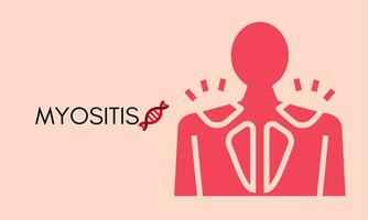 myositis vector illustratie voor medisch icoon