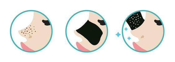 richting voor gebruik mee-eter porie strip behandeling vector icoon reeks illustratie Aan wit achtergrond. hoe naar gebruik mee-eter verwijdering neus- porie strip en onthullen schoonheid huid. voordat en na concept.