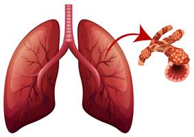 longen met vergrote deel illustratie vector