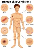 Verschillende menselijke huidaandoeningen vector