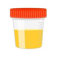 urineonderzoek. urinemonster in plastic container vector