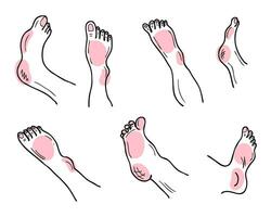 hand- getrokken voeten en poten lichaam onderdelen verzameling. Gezondheid zorg, kunstmatig en behandeling concept. vector