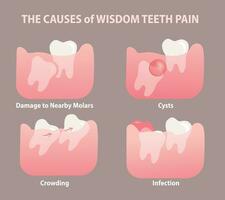 de oorzaken van wijsheid tand pijn illustratie vector