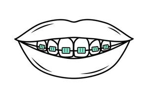 menselijk mond met tanden in een beugel in tekening stijl. correctief orthodontie. tandheelkundig zorg. lineair vector illustratie.