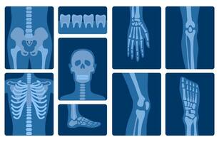 tekenfilm kleur x-ray schoten menselijk skelet lichaam onderdelen set. vector