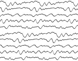 lijn lijn diagram patroon , vector grafisch met abstract ontwerp.