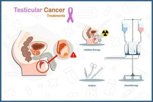 testiculaire kanker behandeling. medisch illustratie vector concept in vlak stijl van testiculaire kanker behandeling omvat chirurgie, chemotherapie en straling therapie.