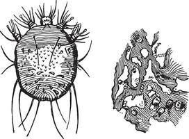 a-acarus schurft, b-gedeelte van opperhuid, tonen de holen met hun bevat eieren, wijnoogst gravure. vector