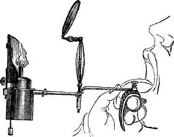 portable laryngoscoop, wijnoogst gravure vector