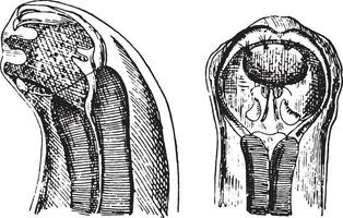 cefalisch uiteinde van dochmius duodenalis, wijnoogst gravure. vector