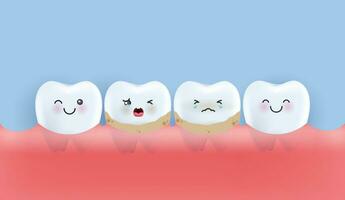 tanden is behandelen groot ongezond tanden plaquette, schalen, boren plaque en cariës tanden. tanden karakter voor kinderen. schattig tandarts mascotte voor medisch appjes, websites en ziekenhuis. vector ontwerp.