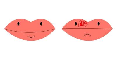 lippen close-up met koude herpes, pijn op de lip, vectorillustratie vector