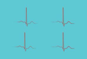 ventriculaire repolarisatie, hart- fiets, ecg van hart in normaal sinus ritme, qt interval van bijv. vector