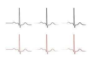 ventriculaire repolarisatie, hart- fiets, ecg van hart in normaal sinus ritme, qt interval van bijv. vector