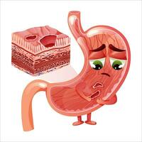 maag zweren. schattig en verdrietig maag karakter met gezicht en twee zweren. maag kruis sectie diagram. anatomisch vector illustratie