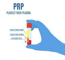 hand- Holding een test buis gevulde met bloed voor bloedplaatje rijk plasma injectie procedure. test buis gevulde met bloed na centrifuge voor prp injectie procedures.vector illustratie in vlak stijl vector