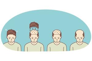 stadia Aan Mens haar- transplantatie. behandeling van kaalheid en alopecia. reeks van mannetje geduldig folliculair eenheid extractie. vector illustratie.