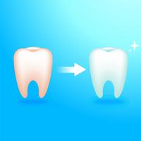 Vuile en schone tand. Behandeling bij de tandarts. Pijnlijke tanden. Vector realistische illustratie