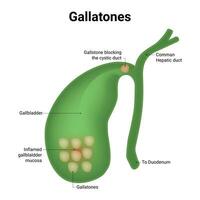 gallatonen wetenschap ontwerp vector illustratie diagram