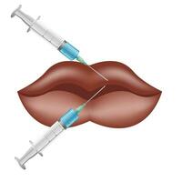lip vergroting en correctie. lip vulmiddel injecties. hyaluronzuur zuur vector