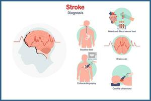 gezondheidszorg concept illustratie.vector in vlak stijl van beroerte diagnose, hersenen scannen, hart en bloed schepen testen, echocardiografie, halsslagader echografie.wetenschap illustraties. vector