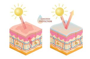 menselijk huid uv stralen bescherming, voordat en na zonnescherm. zon jeva, uvb opperhuid schade het voorkomen lotion. huid zonnebrand vector infographic