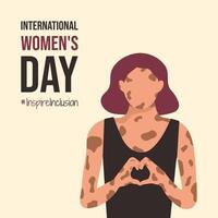 inspireren inclusie Internationale vrouwen dag ansichtkaart. 8 maart 2024 tonen hart met uw handen. inspirereninclusie leuze en gezichtsloos meisje met vitiligo of depigmentatie huid tonen zingen van thema. vector