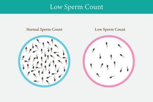 normaal en laag sperma tellen illustratie. mannetje onvruchtbaarheid oligospermie. structuur van de sperma. vector. eps 10 vector