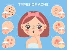 meisje met acne. jong ongelukkig vrouw gezicht met huid problemen en puistje types pictogrammen. dermatologie en kunstmatig huid zorg vector infographic