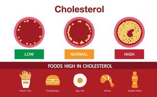 cholesterol in slagader, gezondheidsrisico, vectorontwerp, voedingsmiddelen met een hoog cholesterolgehalte vector