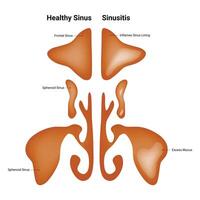gezond sinus sinusitis wetenschap ontwerp vector illustratie diagram