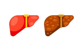 gezond lever en lever cirrhosis ziekte. menselijk lever orgaan. vector illustratie