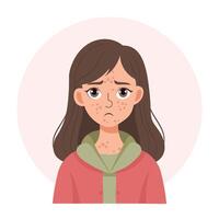 acne. ongelukkig tiener- meisje met acne en puistjes Aan haar gezicht. geërgerd gelaats huid. illustratie, vector