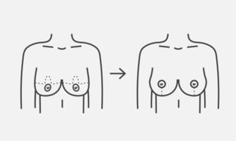 correctie vrouw borst lijn icoon. plastic chirurgie procedure. vector illustratie
