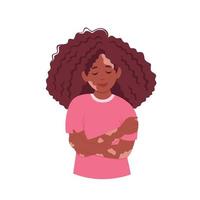 zwarte vrouw met vitiligo. wereld vitiligo dag. zelfzorg, zelfliefde, lichaam positief. vector