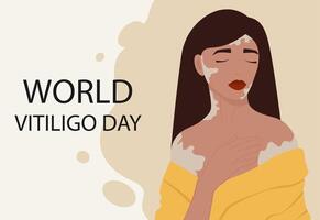 jong Kaukasisch meisje illustratie met vitiligo spandoek. wereld vitiligo dag. vector