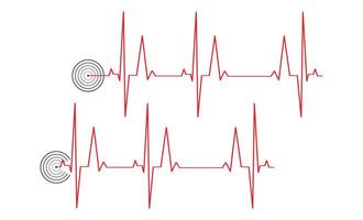 ecg hart ritme lijn icoon symbool, hart ritme pulse ziekenhuis logo teken. vector