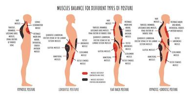 vergelijking van spier onbalans in divers posturaal aandoeningen. kyfotisch, heerszuchtig, vlak terug houding infographics. vector