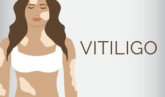 vitiligo huid ziekte banier achtergrond vector