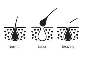 haar- verwijdering geïsoleerd pictogrammen voor normaal, scheren en laser vector