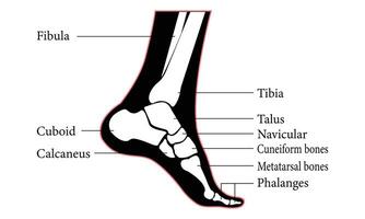 voet bot letsel anatomie diagram illustratie ontwerp. vector