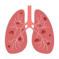 ongezond longen geïsoleerd Aan wit vector