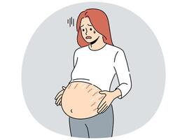 zwanger vrouw met striae Aan buik vector